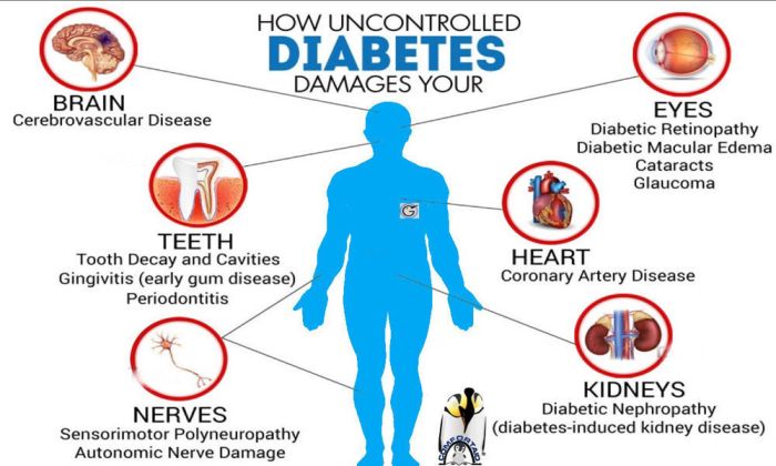 Uji kesehatan sederhana untuk mendeteksi risiko diabetes sejak dini