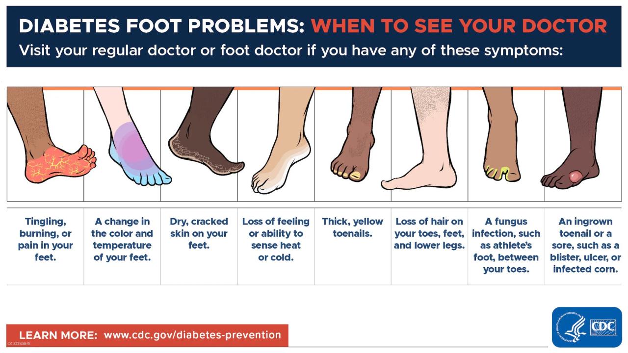 Bahaya mengabaikan kaki hitam karena diabetes melitus