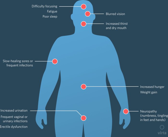 Diabetes symptoms treatment