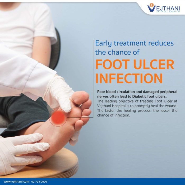 Foot diabetic ulcer treatment topical wounds chronic therapy bangalore doctor patients find oxygen spray