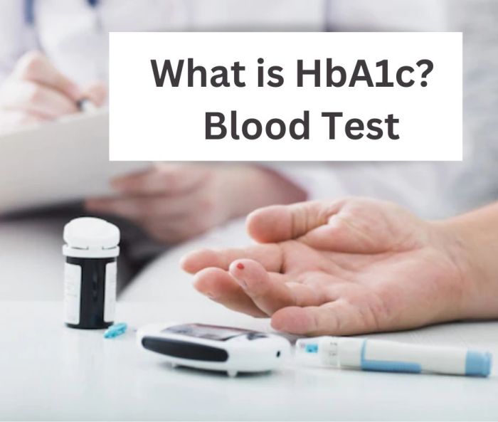 Konsultasi dokter spesialis apa yang tepat untuk HBA1c tinggi?