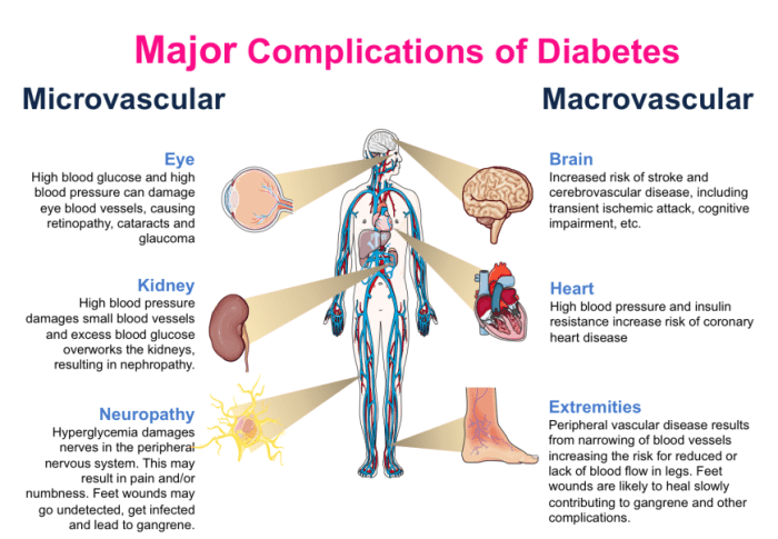 Diabetes complications prevent olah verywell