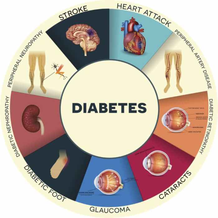 Xylitol dan risiko komplikasi diabetes jangka panjang.