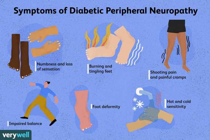 Mengobati saraf terjepit di kaki karena diabetes mellitus