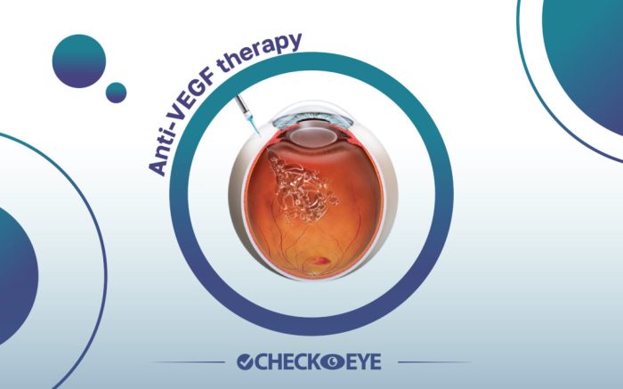 Apakah suntikan anti-VEGF efektif untuk retinopati diabetik?