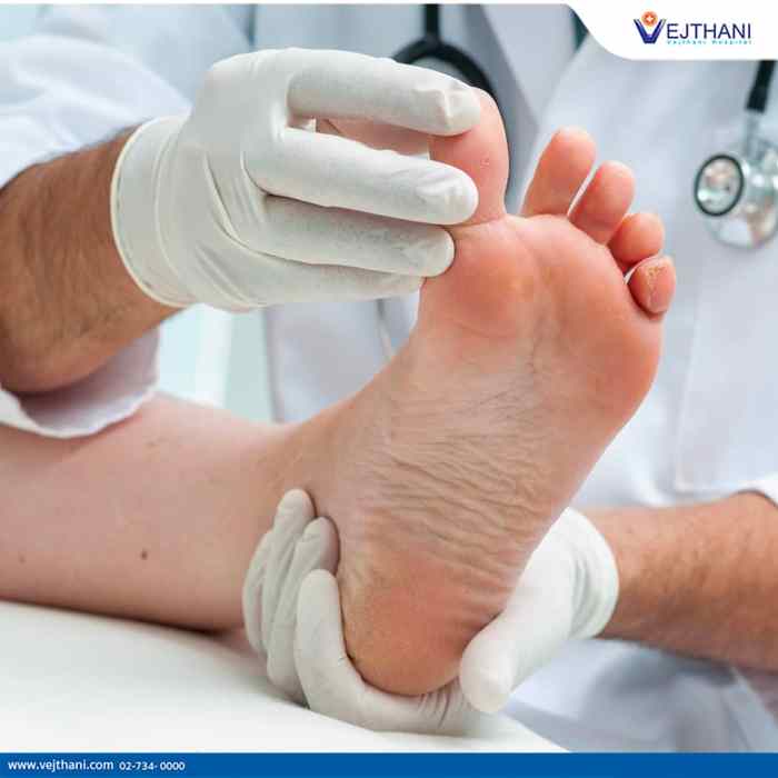 Foot diabetes wounds care type wound if thinkstock