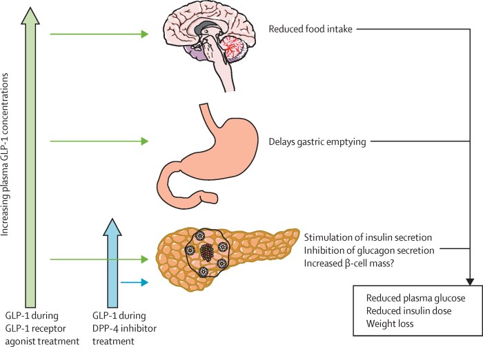 Pengobatan alternatif untuk diabetes tipe 1 selain insulin