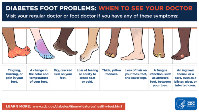 Diabetes diabetic infographic neuropathy podiatry donts patients causes symptom gestational disease glucose mellitus