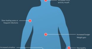 Diabetes symptoms treatment