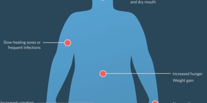 Diabetes symptoms treatment