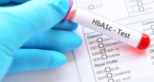 Bagaimana cara mendiagnosis penyebab HBA1c tinggi secara akurat?