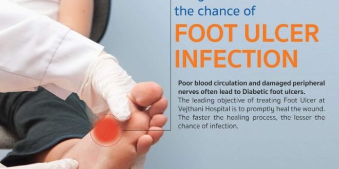 Foot diabetic ulcers prevent ulcer treatment complications help humana diabetes patient cause hospitalization common those