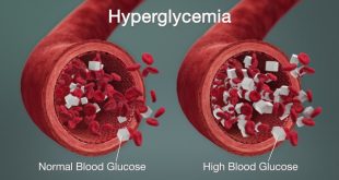 Apa penyebab gula darah tinggi selain diabetes dan bagaimana mengobatinya?