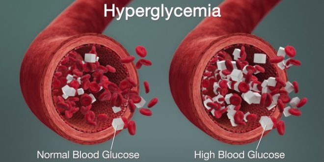 Apa penyebab gula darah tinggi selain diabetes dan bagaimana mengobatinya?