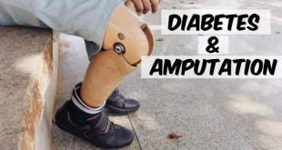 Mencegah amputasi kaki akibat komplikasi diabetes