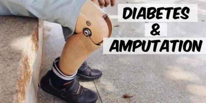 Mencegah amputasi kaki akibat komplikasi diabetes