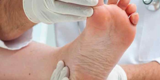 Foot diabetes wounds care type wound if thinkstock