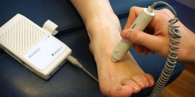 Konsultasi dokter spesialis kaki hitam akibat diabetes online