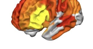 Excitotoxicity dmt