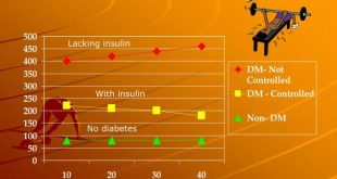 Exercise blood sugar intensity after levels high diabetes control glucose weight increases activity between aerobic pre