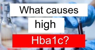 Konsultasi dokter spesialis apa yang tepat untuk HBA1c tinggi?