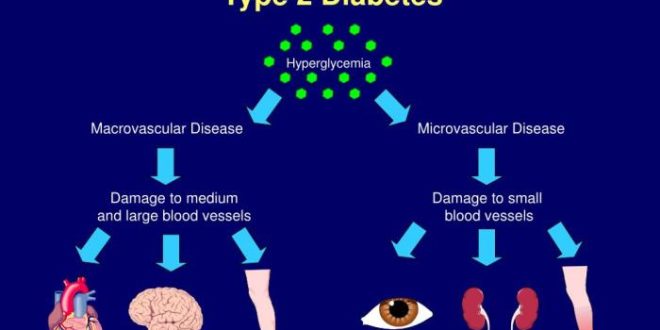 Cara mengatasi komplikasi diabetes melitus tipe 2 jangka panjang