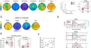 Studi ilmiah terbaru mengenai efek neurologis DMT2 pada otak manusia